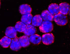TLR9 was detected in immersion fixed mouse splenocytes using Rabbit Anti-Mouse TLR9 Monoclonal Antibody (Catalog # MAB7960) at 0.5 µg/mL for 3 hours at room temperature. Cells were stained using the NorthernLights™ 557-conjugated Anti-Rabbit IgG Secondary Antibody (red; Catalog # NL004) and counterstained with DAPI (blue). Specific staining was localized to cell surfaces and cytoplasm. View our protocol for Fluorescent ICC Staining of Non-adherent Cells.