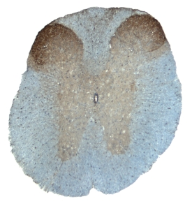 TMEFF1/Tomoregulin-1 was detected in perfusion fixed frozen sections of mouse spinal cord using 15 µg/mL Goat Anti-Mouse TMEFF1/Tomoregulin-1 Antigen Affinity-purified Polyclonal Antibody (Catalog # AF1995) overnight at 4 °C. Tissue was stained with the Anti-Goat HRP-DAB Cell & Tissue Staining Kit (brown; Catalog # CTS008) and counterstained with hematoxylin (blue). View our protocol for Chromogenic IHC Staining of Frozen Tissue Sections.