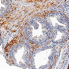 TMEM219 was detected in immersion fixed paraffin-embedded sections of human prostate gland using Sheep Anti-Human TMEM219 Antigen Affinity-purified Polyclonal Antibody (Catalog # AF7556) at 1 µg/mL overnight at 4 °C. Tissue was stained using the Anti-Sheep HRP-DAB Cell & Tissue Staining Kit (brown; Catalog # CTS019) and counterstained with hematoxylin (blue). Specific staining was localized to cytoplasm in stromal cells. View our protocol for Chromogenic IHC Staining of Paraffin-embedded Tissue Sections.
