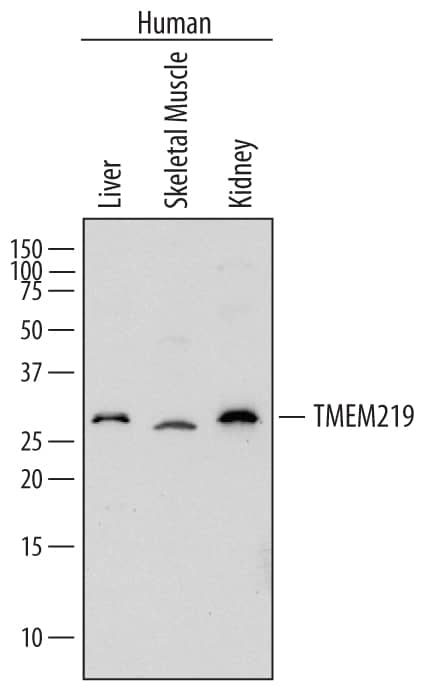 Western blot shows lysates of human liver tissue, human skeletal muscle tissue, and human kidney tissue. PVDF membrane was probed with 1 µg/mL of Sheep Anti-Human TMEM219 Antigen Affinity-purified Polyclonal Antibody (Catalog # AF7556) followed by HRP-conjugated Anti-Sheep IgG Secondary Antibody (Catalog # HAF016). A specific band was detected for TMEM219 at approximately 30 kDa (as indicated). This experiment was conducted under reducing conditions and using Immunoblot Buffer Group 1.