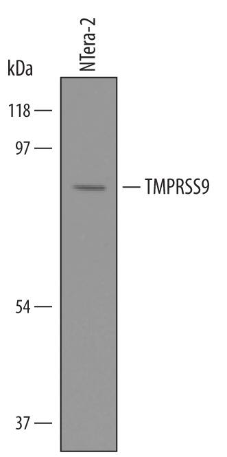 Western blot shows lysates of NTera-2 human testicular embryonic carcinoma cell line. PVDF Membrane was probed with 1 µg/mL of Human TMPRSS9 Antigen Affinity-purified Polyclonal Antibody (Catalog # AF5688) followed by HRP-conjugated Anti-Goat IgG Secondary Antibody (Catalog # HAF019). A specific band was detected for TMPRSS9 at approximately 90 kDa (as indicated). This experiment was conducted under reducing conditions and using Immunoblot Buffer Group 8.