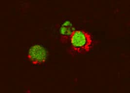 Immunocytochemistry TNF-alpha Antibody [Unconjugated]