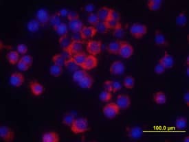 Immunocytochemistry TNF-alpha Antibody [Unconjugated]