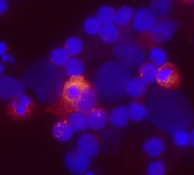 Lymphotoxin-a/TNF-beta  was detected in immersion fixed human peripheral blood mononuclear cells (PBMCs) stimulated with LPS and monensin using Mouse Anti-Human Lymphotoxin-a/TNF-beta  Monoclonal Antibody (Catalog # MAB211) at 10 µg/mL for 3 hours at room temperature. Cells were stained using the NorthernLights™ 557-conjugated Anti-Mouse IgG Secondary Antibody (red; Catalog # NL007) and counter-stained with DAPI (blue). View our protocol for Fluorescent ICC Staining of Non-adherent Cells.