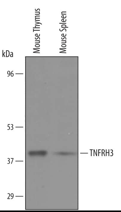 Western blot shows lysates of mouse thymus tissue and mouse spleen tissue. PVDF membrane was probed with 1 µg/mL of Sheep Anti-Mouse TNFRH3/TNFRSF26 Antigen Affinity-purified Polyclonal Antibody (Catalog # AF5330) followed by HRP-conjugated Anti-Sheep IgG Secondary Antibody (Catalog # HAF016). A specific band was detected for TNFRH3/TNFRSF26 at approximately 39 kDa (as indicated). This experiment was conducted under reducing conditions and using Immunoblot Buffer Group 8.