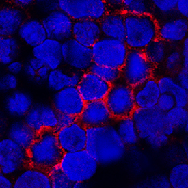 Immunocytochemistry TNF RII/TNFRSF1B Antibody (22221) [Unconjugated]