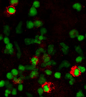 TNF RI/TNFRSF1A was detected in immersion fixed human peripheral blood lymphocytes using 5 &micro;g/mL Human TNF RI/TNFRSF1A Antigen Affinity-purified Polyclonal Antibody (Catalog # AF225) for 3 hours at room temperature. Cells were stained (red) and counterstained (green). View our protocol for Fluorescent ICC Staining of Non-adherent Cells.