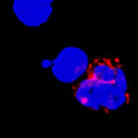 TNF-a was detected in immersion fixed human peripheral blood mononuclear cells (PBMCs) using Goat Anti-Human TNF-a Antigen Affinity-purified Polyclonal Antibody (Catalog # AF-210-NA) at 5 µg/mL for 3 hours at room temperature. Cells were stained using the NorthernLights™ 557-conjugated Anti-Goat IgG Secondary Antibody (red; Catalog # NL001) and counterstained with DAPI (blue). Specific staining was localized to cytoplasm. View our protocol for Fluorescent ICC Staining of Non-adherent Cells.
