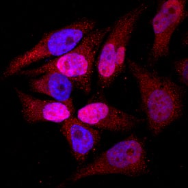 TOP2A was detected in immersion fixed HeLa human cervical epithelial carcinoma cell line using Mouse Anti-Human TOP2A Monoclonal Antibody (Catalog # MAB6540) at 10 µg/mL for 3 hours at room temperature. Cells were stained using the NorthernLights™ 557-conjugated Anti-Mouse IgG Secondary Antibody (red; Catalog # NL007) and counterstained with DAPI (blue). Specific staining was localized to cytoplasm and nuclei. View our protocol for Fluorescent ICC Staining of Cells on Coverslips.