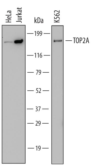 Western blot shows lysates of HeLa human cervical epithelial carcinoma cell line, Jurkat human acute T cell leukemia cell line, and K562 human chronic myelogenous leukemia cell line. PVDF Membrane was probed with 0.5 µg/mL of Mouse Anti-Human TOP2A Monoclonal Antibody (Catalog # MAB6540) followed by HRP-conjugated Anti-Mouse IgG Secondary Antibody (Catalog # HAF007). A specific band was detected for TOP2A at approximately 170 kDa (as indicated). This experiment was conducted under reducing conditions and using Immunoblot Buffer Group 1.