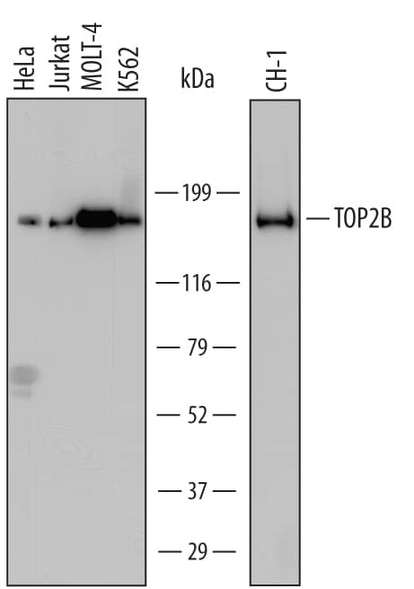 Western blot shows lysates of HeLa human cervical epithelial carcinoma cell line, Jurkat human acute T cell leukemia cell line, MOLT-4 human acute lymphoblastic leukemia cell line, K562 human chronic myelogenous leukemia cell line, and CH-1 mouse B cell lymphoma cell line. PVDF Membrane was probed with 1 µg/mL of Mouse Anti-Human/Mouse TOP2B Monoclonal Antibody (Catalog # MAB6348) followed by HRP-conjugated Anti-Mouse IgG Secondary Antibody (Catalog # HAF007). A specific band was detected for TOP2B at approximately 185 kDa (as indicated). This experiment was conducted under reducing conditions and using Immunoblot Buffer Group 1.