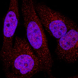 TORC3 was detected in immersion fixed HeLa human cervical epithelial carcinoma cell line using Rabbit Anti-Human TORC3 Monoclonal Antibody (Catalog # MAB9455) at 1 µg/mL for 3 hours at room temperature. Cells were stained using the NorthernLights™ 557-conjugated Anti-Rabbit IgG Secondary Antibody (red; Catalog # NL004) and counterstained with DAPI (blue). Specific staining was localized to nuclei and cytoplasm. View our protocol for Fluorescent ICC Staining of Cells on Coverslips.