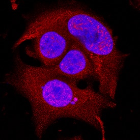 TOR was detected in immersion fixed MCF-7 human breast cancer cell line using Rat Anti-Human TOR Monoclonal Antibody (Catalog # MAB15371) at 8 µg/mL for 3 hours at room temperature. Cells were stained using the NorthernLights™ 557-conjugated Anti-Rat IgG Secondary Antibody (red; Catalog # NL013) and counterstained with DAPI (blue). Specific staining was localized to nuclei. View our protocol for Fluorescent ICC Staining of Cells on Coverslips.