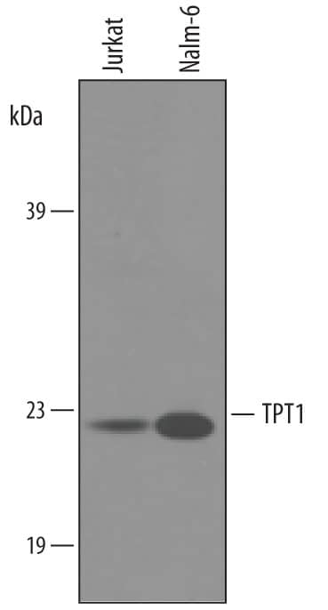 Western blot shows lysates of Jurkat human acute T cell leukemia cell line and Nalm-6 human Pre-B acute lymphocytic leukemia cell line. PVDF membrane was probed with 1 µg/mL of Goat Anti-Human TPT1/TCTP Antigen Affinity-purified Polyclonal Antibody (Catalog # AF4648) followed by HRP-conjugated Anti-Goat IgG Secondary Antibody (Catalog # HAF019). A specific band was detected for TPT1/TCTP at approximately 22 kDa (as indicated). This experiment was conducted under reducing conditions and using Immunoblot Buffer Group 8.