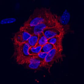 TRA-1-85/CD147 was detected in immersion fixed BG01V human embryonic stem cells on irradiated mouse embryonic fibroblasts using Mouse Anti-Human TRA-1-85/CD147 Monoclonal Antibody (Catalog # MAB3195) at 10 µg/mL for 3 hours at room temperature. Cells were stained using the NorthernLights™ 557-conjugated Anti-Mouse IgG Secondary Antibody (red; Catalog # NL007) and counterstained with DAPI (blue). Specific staining was localized to cytoplasm. View our protocol for Fluorescent ICC Staining of Cells on Coverslips.