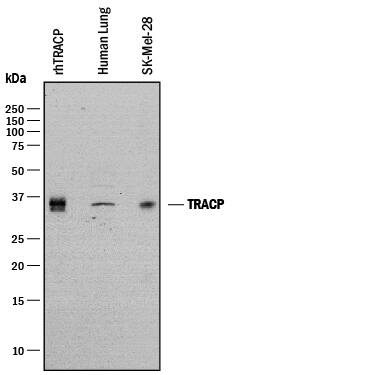 Western blot shows lysates of human lung tissue, SK-Mel-28 human malignant melanoma cell line and Recombinant Human TRACP/PAP/ACP5 (Catalog # 3948-AP). PVDF membrane was probed with 0.5 µg/mL of Sheep Anti-Human TRACP/PAP/ACP5 Antigen Affinity-purified Polyclonal Antibody (Catalog # AF3948) followed by HRP-conjugated Anti-Sheep IgG Secondary Antibody (Catalog # HAF016). A specific band was detected for TRACP/PAP/ACP5 at approximately 36 kDa (as indicated). This experiment was conducted under reducing conditions and using Immunoblot Buffer Group 1.
