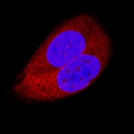 Immunocytochemistry TRADD Antibody [Unconjugated]