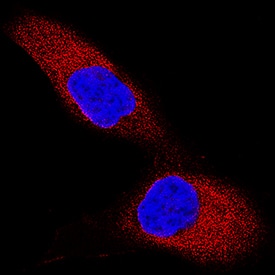 TRAF-2 was detected in immersion fixed HeLa human cervical epithelial carcinoma cell line using Mouse Anti-Human/Mouse/Rat TRAF-2 Monoclonal Antibody (Catalog # MAB3277) at 3 µg/mL for 3 hours at room temperature. Cells were stained using the NorthernLights™ 557-conjugated Anti-Mouse IgG Secondary Antibody (red; Catalog # NL007) and counterstained with DAPI (blue). Specific staining was localized to cytoplasm. View our protocol for Fluorescent ICC Staining of Cells on Coverslips.