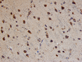 Immunohistochemistry TRAIL/TNFSF10 Antibody [Unconjugated]