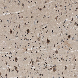 Immunohistochemistry TRAILR1/TNFRSF10A Antibody [Unconjugated]
