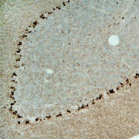 TRAIL R2/TNFRSF10B was detected in perfusion fixed frozen sections of mouse brain (cerebellum) using Rat Anti-Mouse TRAIL R2/TNFRSF10B Monoclonal Antibody (Catalog # MAB1540) at 25 µg/mL overnight at 4 °C. Tissue was stained using the Anti-Rat HRP-DAB Cell & Tissue Staining Kit (brown; Catalog # CTS017) and counter-stained with hematoxylin (blue). Specific staining was localized to cytoplasm of Purkinje neurons. View our protocol for Chromogenic IHC Staining of Frozen Tissue Sections.