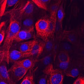 TRAM/TICAM2 was detected in immersion fixed C2C12 mouse myoblast cell line using Rat Anti-Mouse TRAM/TICAM2 Monoclonal Antibody (Catalog # MAB43481) at 10 µg/mL for 3 hours at room temperature. Cells were stained using the NorthernLights™ 557-conjugated Anti-Rat IgG Secondary Antibody (red; Catalog # NL013) and counterstained with DAPI (blue). Specific staining was localized to cytoplasm. View our protocol for Fluorescent ICC Staining of Cells on Coverslips.