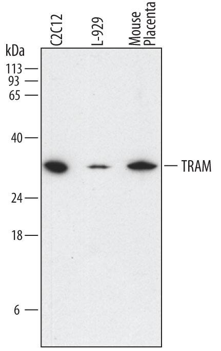 Western blot shows lysates of C2C12 mouse myoblast cell line, L-929 mouse fibroblast cell line, and mouse placenta tissue. PVDF membrane was probed with 2 µg/mL of Rat Anti-Mouse TRAM/TICAM2 Monoclonal Antibody (Catalog # MAB4348) followed by HRP-conjugated Anti-Rat IgG Secondary Antibody (Catalog # HAF005). A specific band was detected for TRAM/TICAM2 at approximately 31 kDa (as indicated). This experiment was conducted under reducing conditions and using Immunoblot Buffer Group 1.