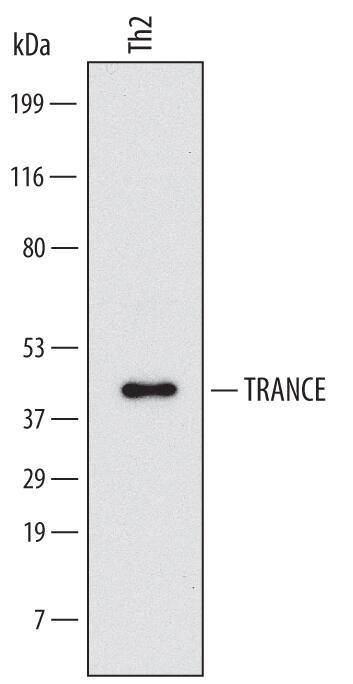 Western blot shows lysates of human primary differentiated CD4+Th2 cells. PVDF Membrane was probed with 2 µg/mL of Human TRANCE/TNFSF11/RANK L Monoclonal Antibody (Catalog # MAB6263) followed by HRP-conjugated Anti-Mouse IgG Secondary Antibody (Catalog # HAF007). A specific band was detected for TRANCE/TNFSF11/RANK L at approximately 43 kDa (as indicated). This experiment was conducted under reducing conditions and using Immunoblot Buffer Group 1.