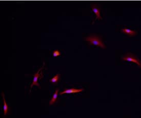 TREM2 was detected in immersion fixed immature human dendritic cells using Goat Anti-Human TREM2 Antigen Affinity-purified Polyclonal Antibody (Catalog # AF1828) at 10 µg/mL for 3 hours at room temperature. Cells were stained using the NorthernLights™ 557-conjugated Anti-Goat IgG Secondary Antibody (red; Catalog # <a class=
