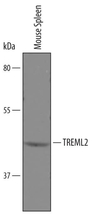 Western Blot TREML2/TLT-2 Antibody