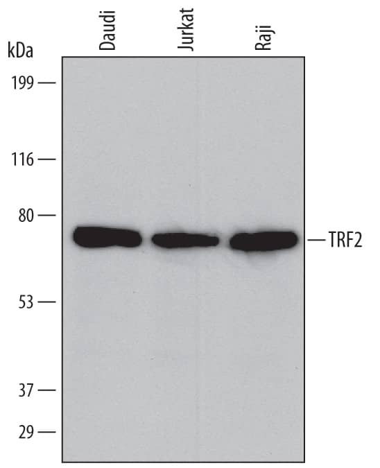 Western blot shows lysates of Daudi human Burkitt's lymphoma cell line, Jurkat human acute T cell leukemia cell line, and Raji human Burkitt's lymphoma cell line. PVDF membrane was probed with 1 µg/mL of Mouse Anti-Human TRF2 Monoclonal Antibody (Catalog # MAB5635) followed by HRP-conjugated Anti-Mouse IgG Secondary Antibody (Catalog # HAF007). A specific band was detected for TRF2 at approximately 75 kDa (as indicated). This experiment was conducted under reducing conditions and using Immunoblot Buffer Group 1.