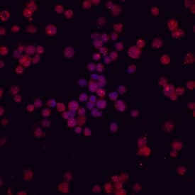 Immunocytochemistry TRIF/TICAM1 Antibody [Unconjugated]