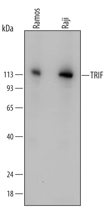 Western Blot TRIF/TICAM1 Antibody [Unconjugated]