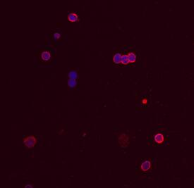 TRIM21 was detected in immersion fixed human peripheral blood mononuclear cells (PBMCs) stimulated for 8 hours with 20 ng/mL Recombinant Human IFN-gamma (Catalog # 285-IF) using Human TRIM21 Antigen Affinity-purified Polyclonal Antibody (Catalog # AF6219) at 10 µg/mL for 3 hours at room temperature. Cells were stained using the NorthernLights™ 557-conjugated Anti-Sheep IgG Secondary Antibody (red; NL010) and counterstained with DAPI (blue). Specific staining was localized to cytoplasm. View our protocol for Fluorescent ICC Staining of Non-adherent Cells.