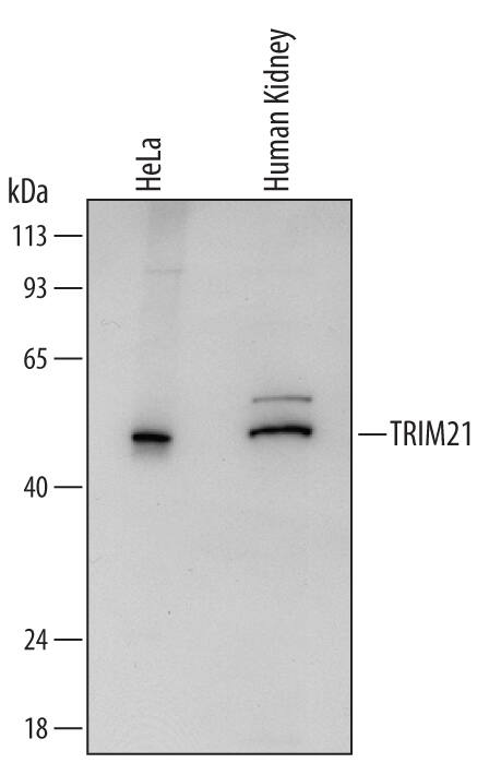 Western blot shows lysates of HeLa human cervical epithelial carcinoma cell line and human kidney tissue. PVDF Membrane was probed with 0.5 µg/mL of Human TRIM21 Antigen Affinity-purified Polyclonal Antibody (Catalog # AF6219) followed by HRP-conjugated Anti-Sheep IgG Secondary Antibody (HAF016). A specific band was detected for TRIM21 at approximately 52 kDa (as indicated). This experiment was conducted under reducing conditions and using Immunoblot Buffer Group 2.