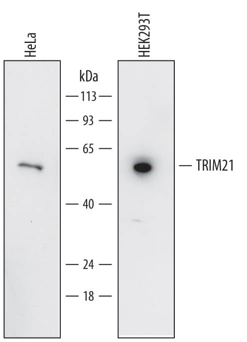 Western blot shows lysates of HeLa human cervical epithelial carcinoma cell line and HEK293T human embryonic kidney cell line. PVDF membrane was probed with 1 µg/mL of Mouse Anti-Human TRIM21 Monoclonal Antibody (Catalog # MAB62191) followed by HRP-conjugated Anti-Mouse IgG Secondary Antibody (HAF007). A specific band was detected for TRIM21 at approximately 54 kDa (as indicated). This experiment was conducted under reducing conditions and using Immunoblot Buffer Group 2.