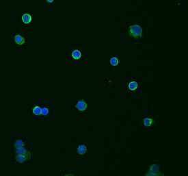 TRIM21 was detected in immersion fixed human peripheral blood mononuclear cells (PBMCs) stimulated for 8 hours with 20 ng/mL of Recombinant Human IFN-gamma (285-IF) using Mouse Anti-Human TRIM21 Monoclonal Antibody (Catalog # MAB6219) at 10 µg/mL for 3 hours at room temperature. Cells were stained using the NorthernLights™ 493-conjugated Anti-Mouse IgG Secondary Antibody (green; NL009) and counterstained with DAPI (blue). Specific staining was localized to cell surfaces and cytoplasm. View our protocol for Fluorescent ICC Staining of Non-adherent Cells.