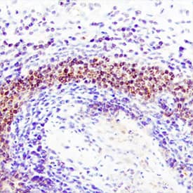Immunohistochemistry TRIM38 Antibody [Unconjugated]