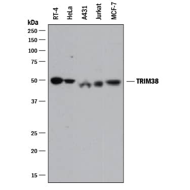 Western Blot TRIM38 Antibody [Unconjugated]