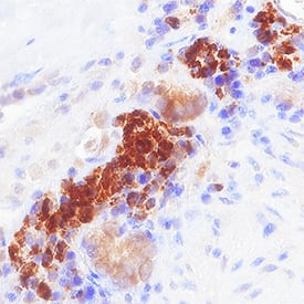 Immunohistochemistry TRIM38 Antibody (933011) [Unconjugated]