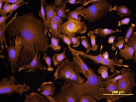 TROP-2 was detected in immersion fixed XB2 mouse teratoma keratinocyte cell line using Goat Anti-Mouse TROP-2 Antigen Affinity-purified Polyclonal Antibody (Catalog # AF1122) at 10 µg/mL for 3 hours at room temperature. Cells were stained using the NorthernLights™ 557-conjugated Anti-Goat IgG Secondary Antibody (yellow; Catalog # NL001) and counterstained with DAPI (blue). View our protocol for Fluorescent ICC Staining of Cells on Coverslips.