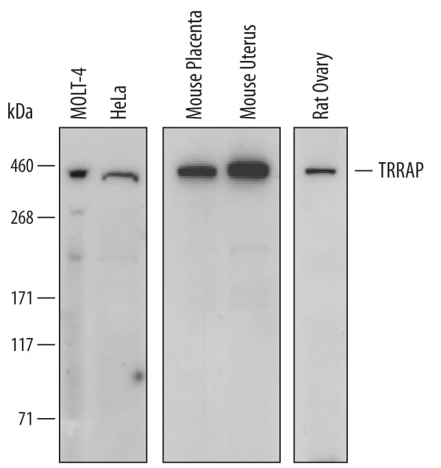 Western Blot TRRAP Antibody