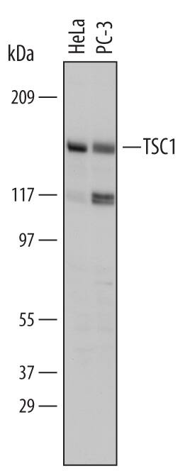 Western Blot TSC1 Antibody (488915)
