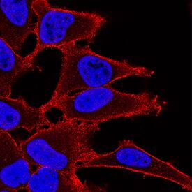 TSC2 was detected in immersion fixed HeLa human cervical epithelial carcinoma cell line using Mouse Anti-Human/Mouse TSC2 Monoclonal Antibody (Catalog # MAB40401) at 3 µg/mL for 3 hours at room temperature. Cells were stained using the NorthernLights™ 557-conjugated Anti-Mouse IgG Secondary Antibody (red; Catalog # NL007) and counterstained with DAPI (blue). Specific staining was localized to plasma membrane. View our protocol for Fluorescent ICC Staining of Cells on Coverslips.