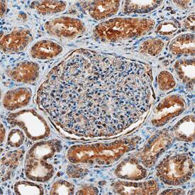 TSC2 was detected in immersion fixed paraffin-embedded sections of human kidney using Mouse Anti-Human/Mouse TSC2 Monoclonal Antibody (Catalog # MAB40401) at 15 µg/mL overnight at 4 °C. Before incubation with the primary antibody, tissue was subjected to heat-induced epitope retrieval using Antigen Retrieval Reagent-Basic (CTS013). Tissue was stained using the Anti-Mouse HRP-DAB Cell & Tissue Staining Kit (brown; CTS002) and counterstained with hematoxylin (blue). Specific staining was localized to epithelial cell cytoplasm in convoluted tubules. View our protocol for Chromogenic IHC Staining of Paraffin-embedded Tissue Sections.
