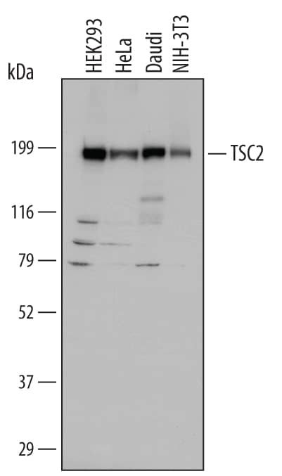 Western blot shows lysates of HEK293 human embryonic kidney cell line, HeLa human cervical epithelial carcinoma cell line, Daudi human Burkitt's lymphoma cell line, and NIH-3T3 mouse embryonic fibroblast cell line. PVDF membrane was probed with 1 µg/mL of Mouse Anti-Human/Mouse TSC2 Monoclonal Antibody (Catalog # MAB40401) followed by HRP-conjugated Anti-Mouse IgG Secondary Antibody (HAF007). A specific band was detected for TSC2 at approximately 200 kDa (as indicated). This experiment was conducted under reducing conditions and using Immunoblot Buffer Group 1.