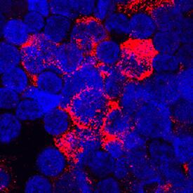 TSG-6 was detected in immersion fixed human peripheral blood mononuclear cells (PBMCs) using Goat Anti-Human TSG-6 Antigen Affinity-purified Polyclonal Antibody (Catalog # AF2104) at 15 µg/mL for 3 hours at room temperature. Cells were stained using the NorthernLights™ 557-conjugated Anti-Goat IgG Secondary Antibody (red; Catalog # NL001) and counterstained with DAPI (blue). Specific staining was localized to cytoplasm. View our protocol for Fluorescent ICC Staining of Cells on Coverslips.