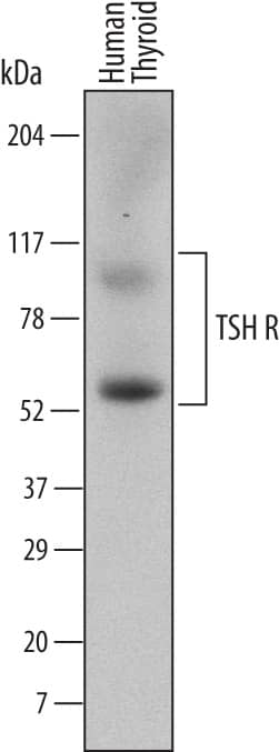 Western Blot TSHR Antibody (484405) [Unconjugated]