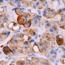 Immunohistochemistry TSH beta Antibody (512908) [Unconjugated]
