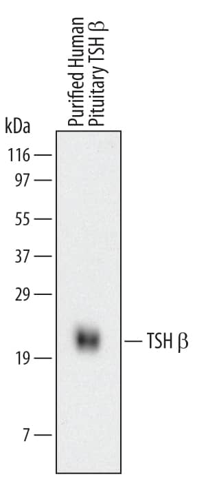Western Blot TSH beta Antibody (512908) [Unconjugated]